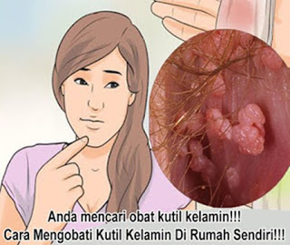 Obat penghilang kutil di kemaluan, obat kutil kelamin atau kutil di kemaluan untuk ibu hamil muda, kutil kelamin atau kutil di kemaluan wanita, obat kutil kelamin atau kutil di kemaluan yg aman bagi ibu hamil, cara alami mengobati gejala kutil kelamin, obat kutil kelamin alami yang manjur, kutil di bulu kemaluan, pengobatan kutil kelamin atau kutil di kemaluan tanpa operasi surabaya, obat herbal kutil kelamin atau kutil di kemaluan untuk ibu hamil, apa obat kutil kelamin atau kutil kelamin, obat oles alami untuk kutil kelamin